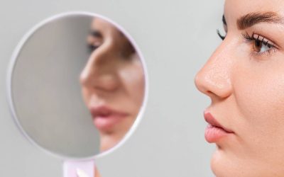 Rinoplastia: cómo lograr armonía facial sin perder naturalidad